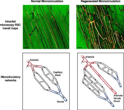 Regenerated Microvascular Networks in Ischemic Skeletal Muscle